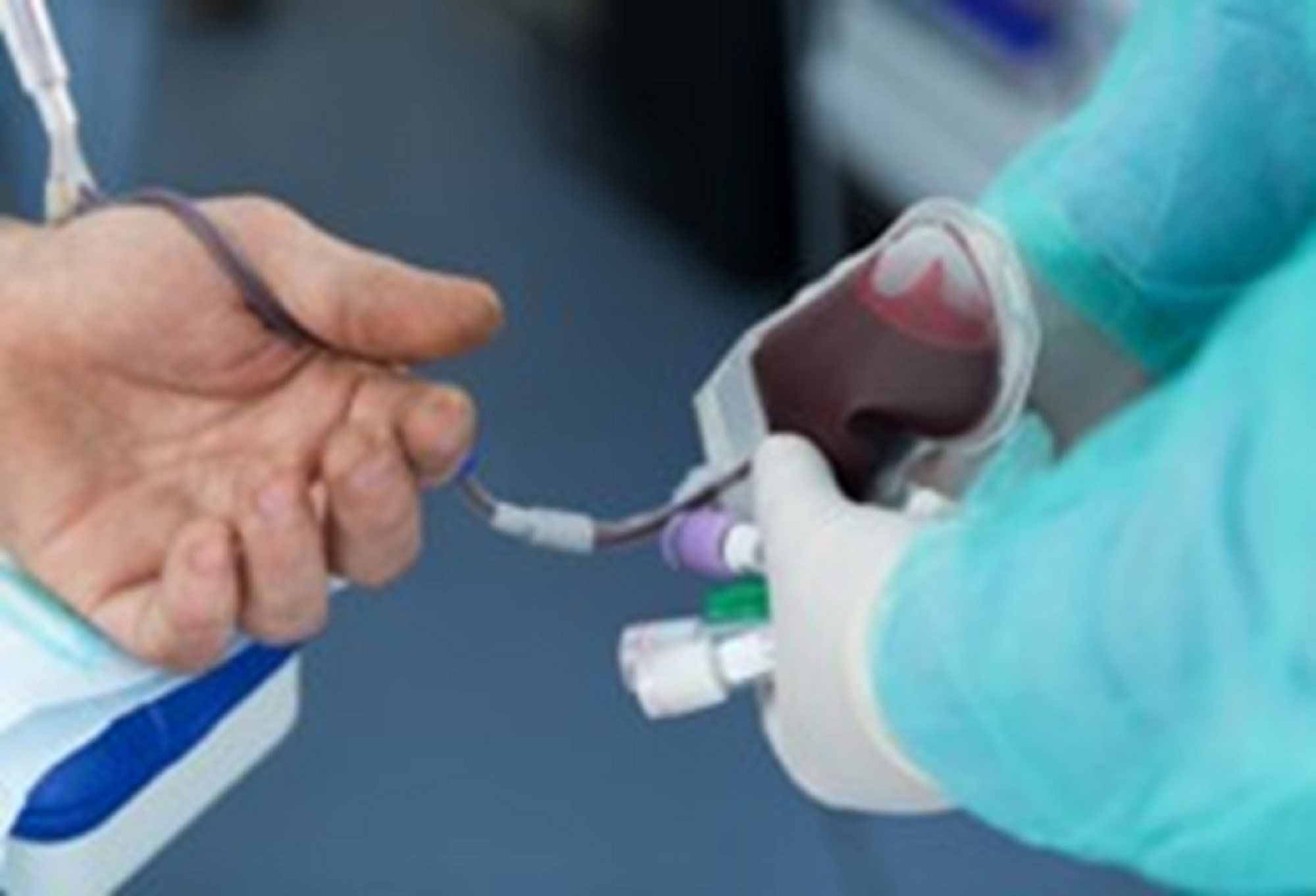 Los Nuevos Desafíos De La Medicina Transfusional Frente Al Cuidado Del Paciente